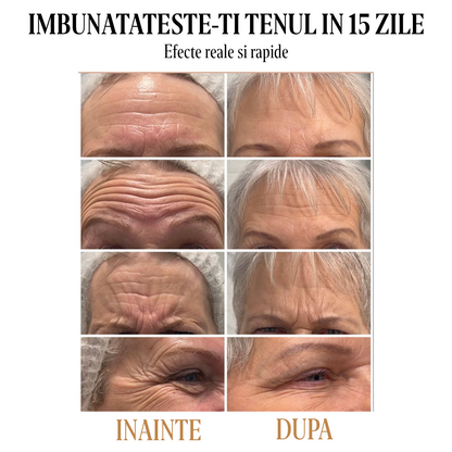 Set 10 Masti Fata Cu Turmeric si Vitamina C